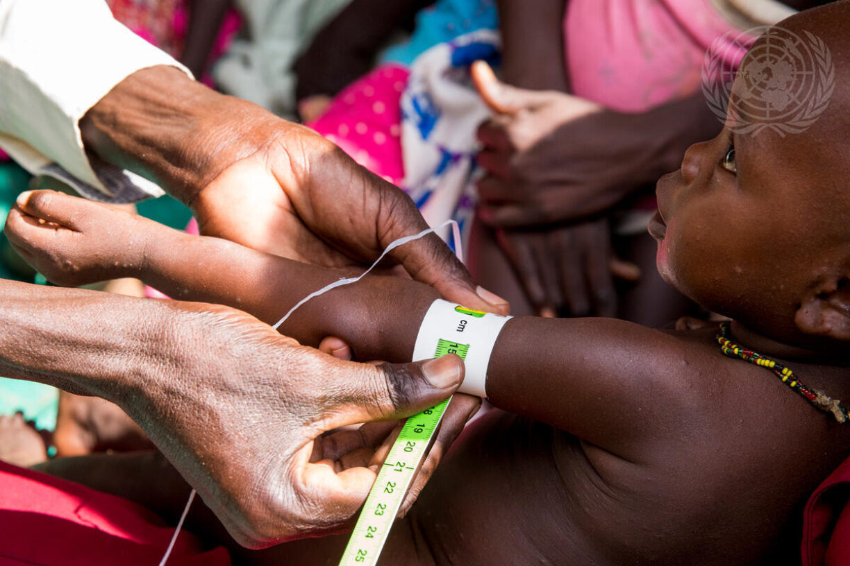 En helsearbeider måler en babys arm i Sør-Sudan. Bildet er fra 2015 og tatt i forbindelse med en ernæringsresponsplan UNICEF og Verdens matvareprogram (WFP) lanserte i landet for behandling og forebygging av akutt underernæring. Foto: UN Photo/JC McIlwaine