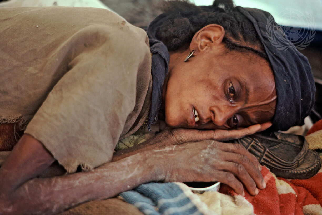 Et offer for tørken på Afrikas horn venter på medisinsk behandling i Makalle, Nord-Etiopia. Tørken herjer på det afrikanske kontinentet, og store deler av befolkningen trues av sult. Foto: UN Photo/John Isaac